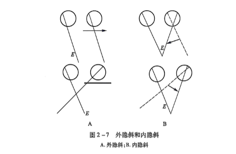 2-7 外隐斜和内隐斜.PNG