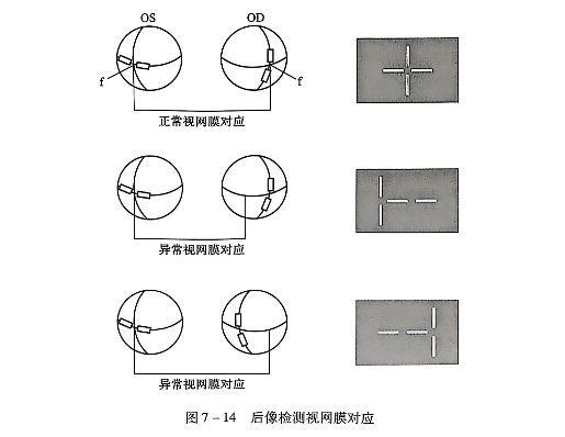 7-14后像检测视网膜对应.PNG