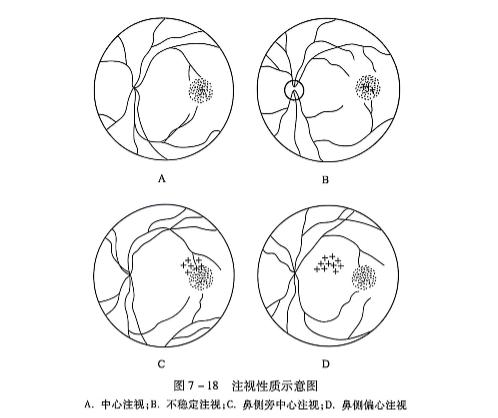 7-18注视性质示意图.PNG