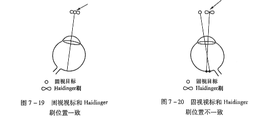 7-19固视视标禾Haidinger刷位置一致7-20固视视标禾Haidinger位置不一致.PNG