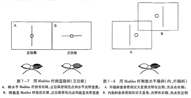 7-7马视杆测量隐斜正位眼7-8马氏杆测量水平隐斜内外隐斜-mTmV.PNG